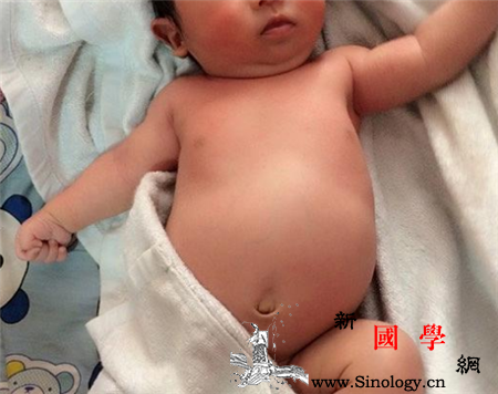 小孩肚子胀气如何排气腹部按摩排气更有效_顺时-排气-腹部-按摩-