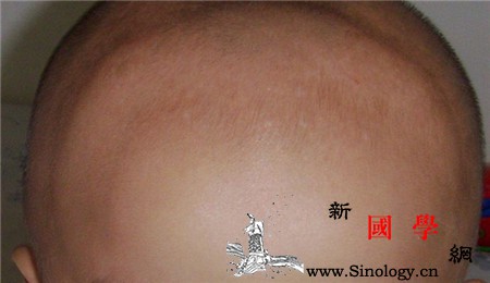 婴儿卤门什么时候闭合囟门早闭可能影响脑部发_囟门-什么时候-闭合-脑部-
