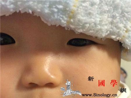 宝宝发烧用热毛巾还是冷毛巾敷分为两种情况_出汗-毛巾-宝宝-孩子-