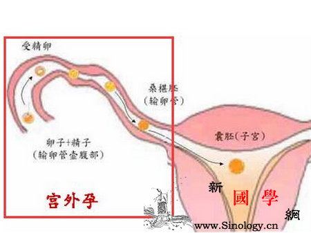怀孕10周注意事项_微克-宫外孕-妊娠-胎儿-
