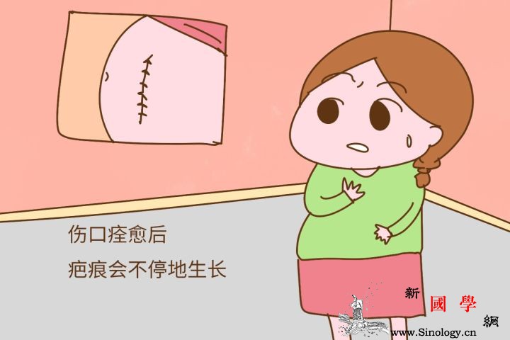 什么是疤痕体质？怎样预防和护理剖腹产疤痕？_奇痒-软膏-剖腹产-增生-