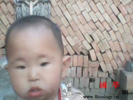 产检可以检查出胎儿的哪些问题_羊水-染色体-孕期-胎儿-