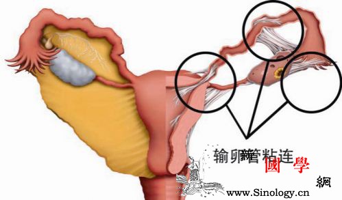 输卵管粘连是怎么造成的？身体有什么感觉？_输卵管-粘连-白带-炎症-怀孕准备