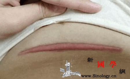 剖腹产孕妈生完宝宝后身体的3处改变你知道吗_顺产-剖腹产-分娩-产后-