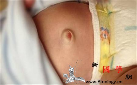 宝宝一哭肚脐就突出是怎么回事_患处-肿块-熨烫-茴香-