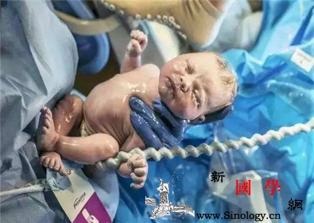 剪脐带的时候妈妈疼吗剪脐带谁会疼？_脐带-剖腹产-分娩-剪断-