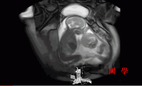 双胞胎在妈妈子宫内竟然这样…忍不住看了一遍又_胚胎-精子-胎儿-卵细胞-