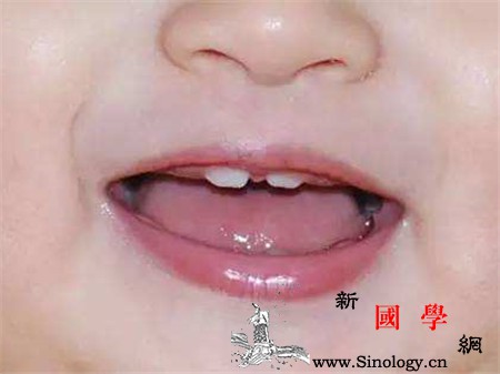 乳牙牙缝大是什么原因_恒牙-乳牙-糖分-龋齿-