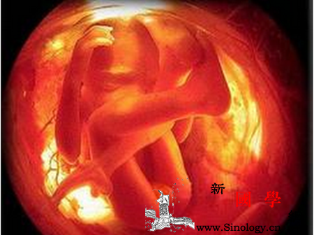 四维彩超数据看男女_股骨-胎儿-形状-四维-