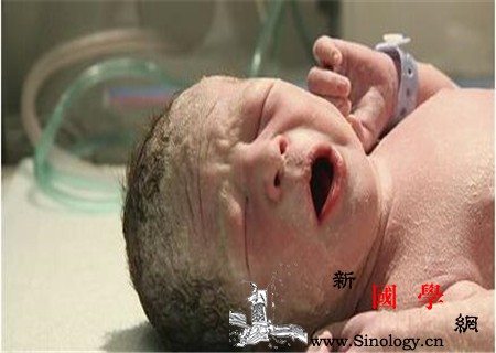 宝宝出生时身上脏脏的是什么是孕期同房的后果_羊水-同房-孕期-胎儿-