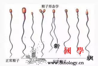 精子畸形率高就一定不可以怀孕吗？_卵子-受精-精子-畸形-遗传优生