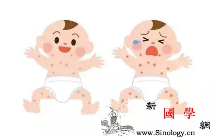 宝宝热疹和湿疹的区别_疹子-皮疹-湿疹-出汗-