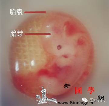 产检科普：胚囊、胎芽、胎心是什么样？_停经-搏动-胚胎-胎儿-