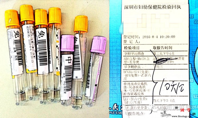 怀孕第12周~13周每次产检“闯次关”心_甜橙-抽血-怀孕-胎心-