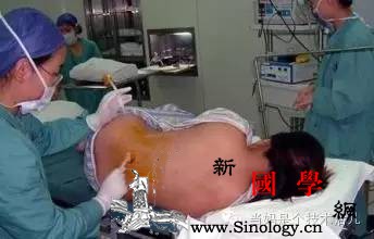 剖宫产宜采何种麻醉方式？会不会伤到孩子？_剖腹产-胎儿-注射-麻醉-