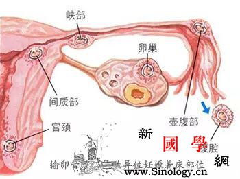 输卵管通而不畅如何才能好孕！_受精卵-宫外孕-输卵管-怀孕-怀孕准备
