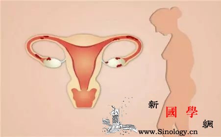 子宫内膜癌通常会发生在哪类女性身上？_绝经-雌激素-患有-子宫内膜-