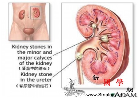 肾盂分离的原因是什么_肾盂-正常值-羊水-胎儿-