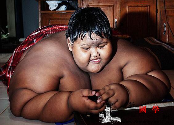 世界最胖男孩重380斤光缩胃手术就需要5个_减掉-爪哇-利亚-印度尼西亚-