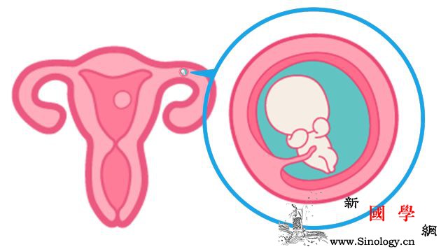 确诊宫外孕以后还能保留输卵管吗？_宫外孕-输卵管-手术-再次-怀孕准备