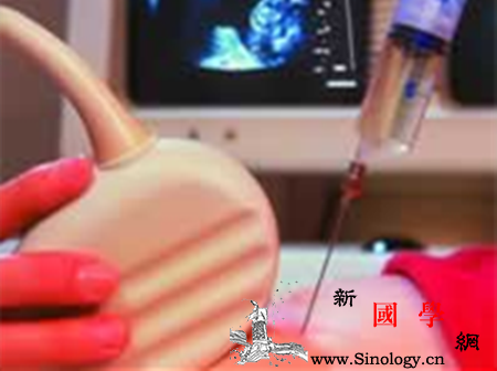 为什么要做羊水穿刺检查_羊膜-羊水-染色体-穿刺-