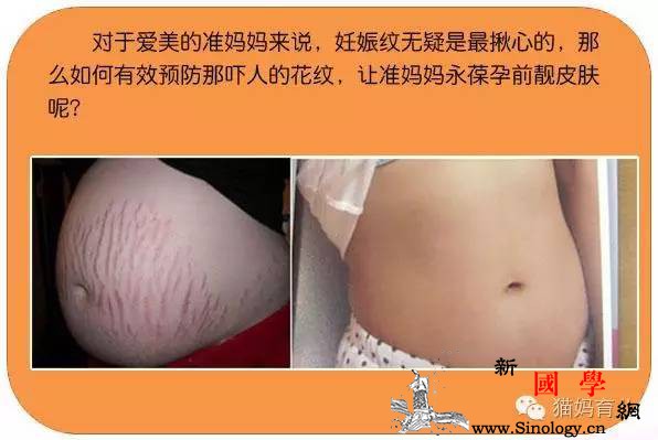 微信疯传89593次的预防妊娠纹方法轻松_搞定-预防-轻松-完美-