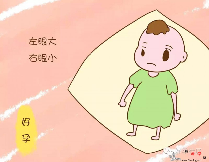 孕期不要长期左侧睡眠不然像她宝宝一样出生后_侧卧-孕期-胎儿-生下-