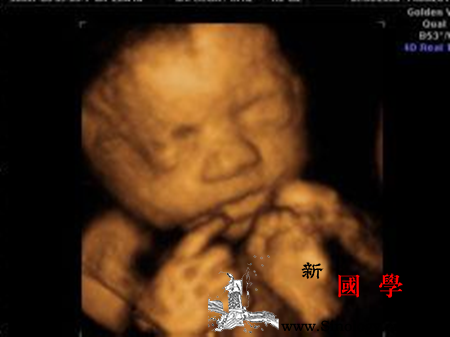 四维彩超查男女准吗_孕期-胎儿-四维-性别-