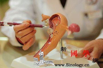 输卵管堵塞该怎么检查？有哪些症状！_造影-输卵管-痛经-堵塞-孕前检查