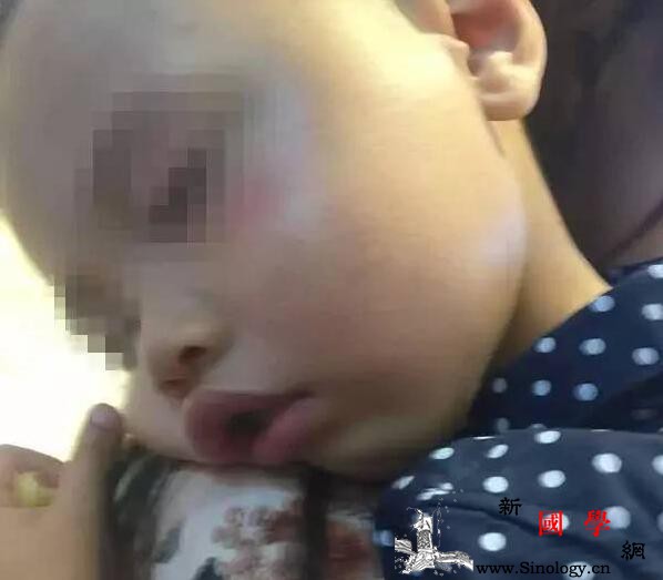 2岁娃被一女子打一巴掌致孩子后脑勺着地鼻子_店门-告诉记者-王女士-女子-