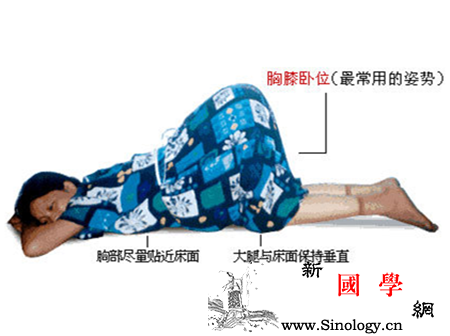 胎儿臀位怎么纠正_胎位-骨盆-针灸-分娩-