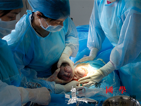 胎儿臀位多少周剖腹产_剖腹产-胎儿-产后-纠正-