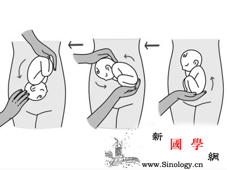 臀位外倒转术时间_胎位-羊水-倒转-胎儿-