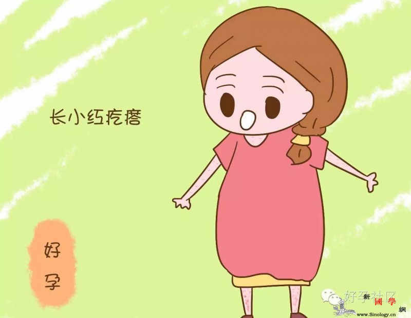 孕晚期为了宝宝每晚绑着双手睡觉这滋味真酸爽_妊娠-几天-瘙痒-疙瘩-