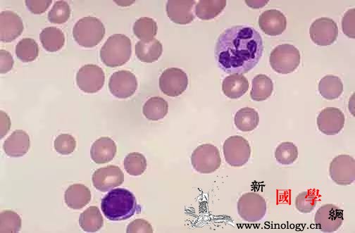 妊娠期贫血指南妊娠期贫血知多少？_叶酸-贫血-胎儿-口服-