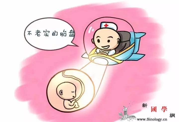 孕期B超专业术语解读之——前置胎盘_胎盘-孕期-胎儿-子宫-