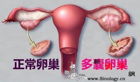 多囊备孕你遇到这些问题没？_卵泡-排卵期-输卵管-排卵-怀孕准备