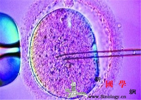 人工授精容易流产吗症状预防了解下_腹痛-妊娠-阴道-流产-遗传优生