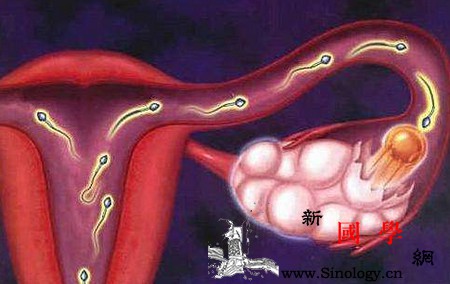 多囊卵巢综合症是遗传的吗？_患有-遗传-表型-因素-孕前检查