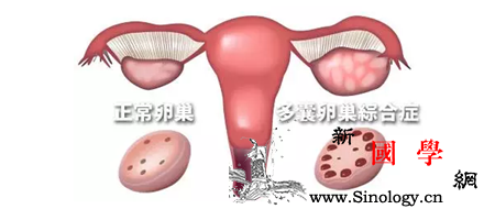 多囊卵巢跟湿气有关系吗多囊是湿气重导致的吗_湿气-痤疮-卵巢-紊乱-怀孕准备