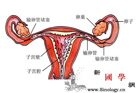 输卵管堵塞了还能怀孕吗？_输卵管-还能-痛经-堵塞-不孕不育