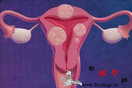 预防子宫肌瘤难不难？_尤其是-流产-子宫肌瘤-怀孕-孕前检查