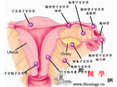 什么是宫外孕_受精卵-着床-宫外孕-输卵管-