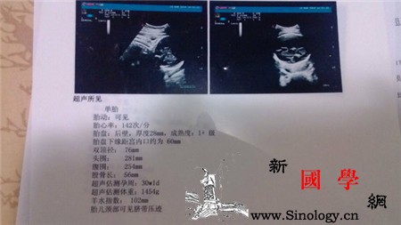 b超数据_胎位-股骨-羊水-胎盘-