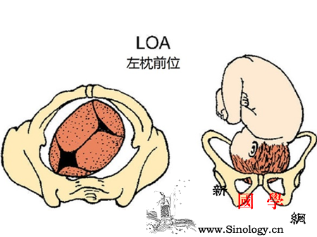 胎位loa是什么意思_枕骨-胎位-顺产-骨盆-