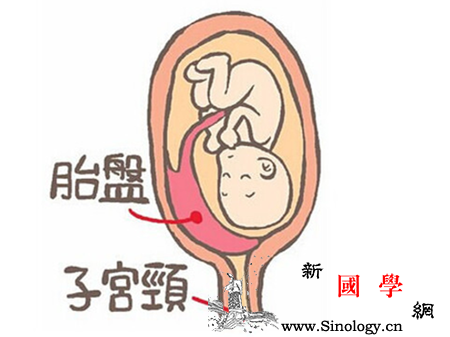 胎盘前壁是什么意思_子宫颈-胎盘-附着-妊娠-