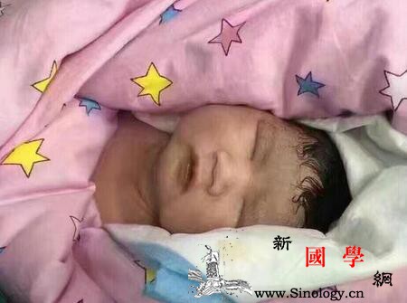 64岁产妇生男婴是怎么回事_生下-男婴-剖腹产-产妇-