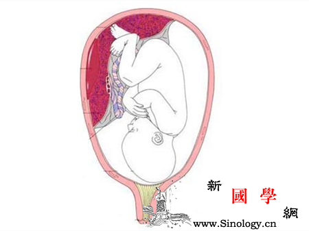 胎盘前壁和后壁的区别_胎盘-早产-附着-产后-