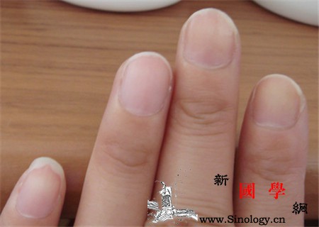 孕妇得了灰指甲怎么办_灰指甲-曝晒-鞋袜-换气-