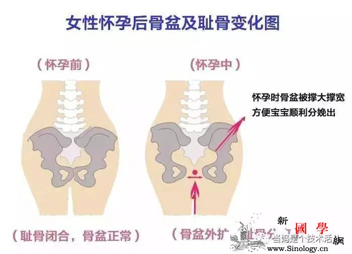 准妈十有八九都得受这个罪！这几招就能轻松解决_耻骨-会有-孕期-分离-